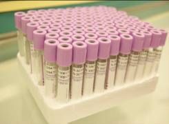 斑马技术提高健康体检的安全性及精准度 斑马技术提高健康体检的安全性及精准度